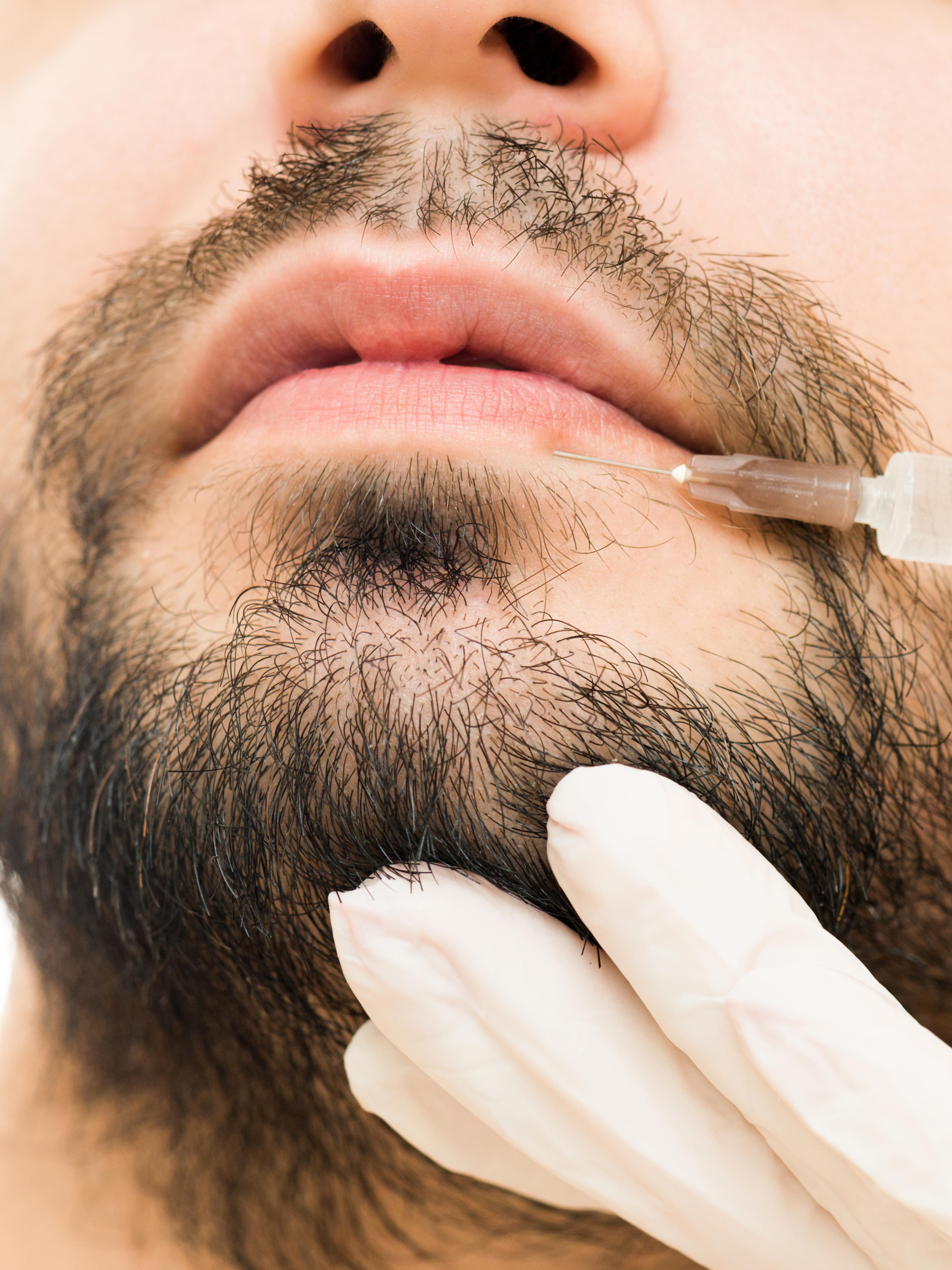Beards, botox and men