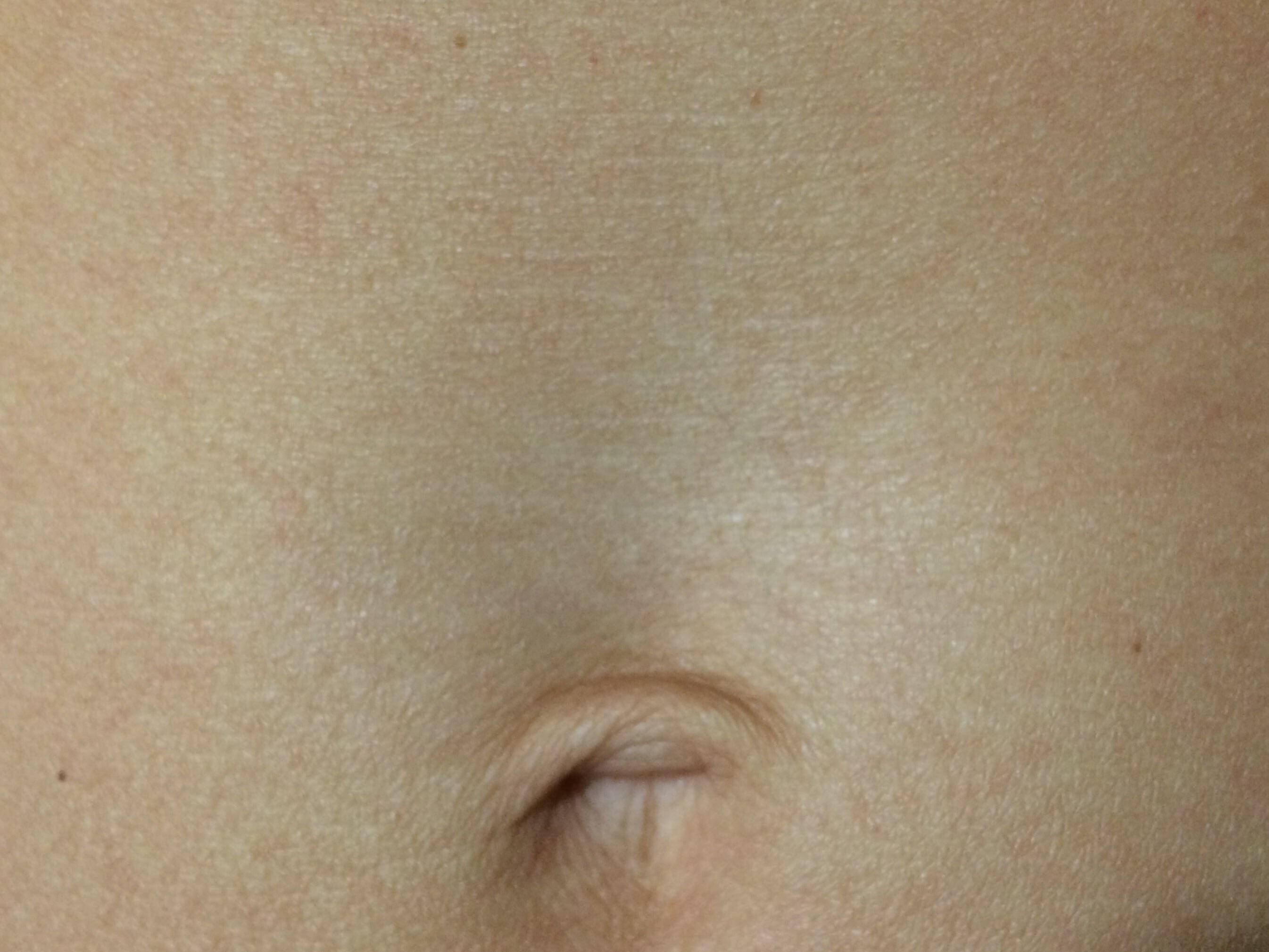 Crepey Creepy skin
