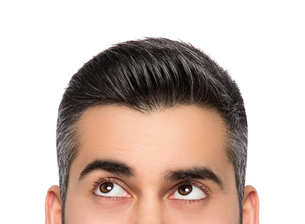 Brow Lift (Forehead Lift) for Men