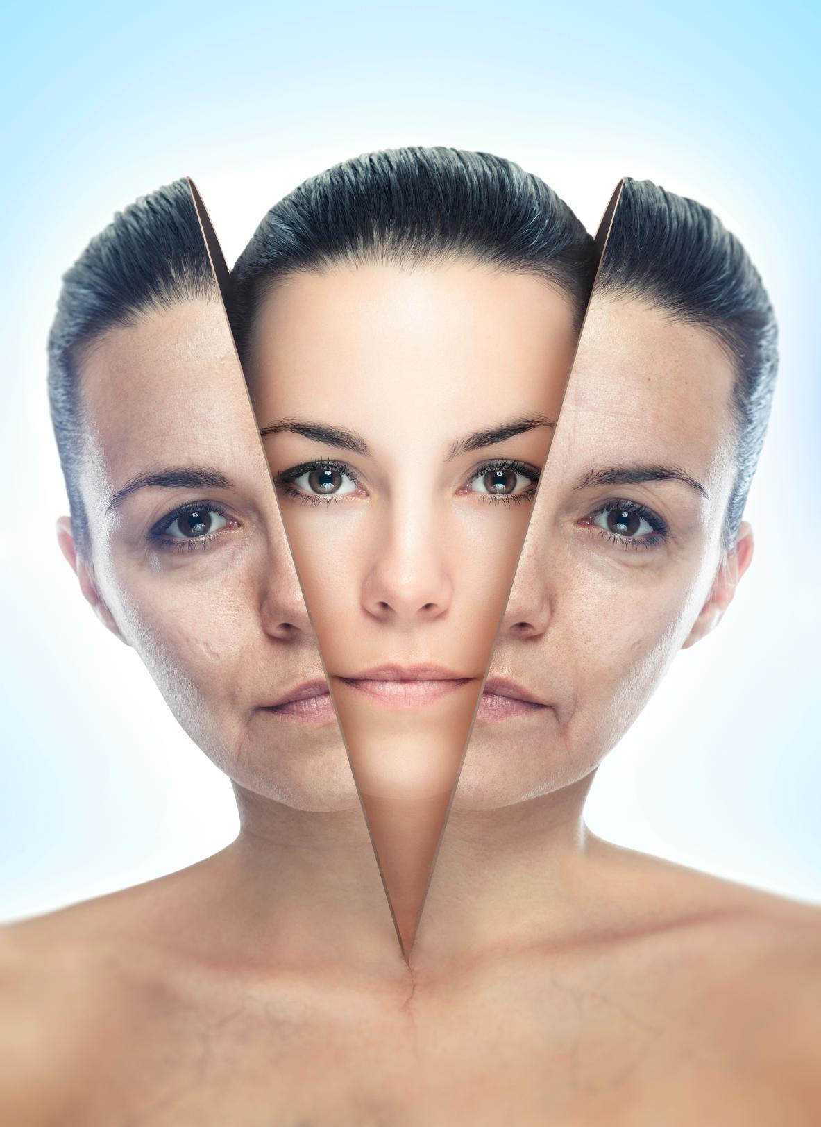 Laser Facial Rejuvenation