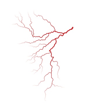 Spider Vein Treatment