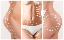 plastic surgeon NJ