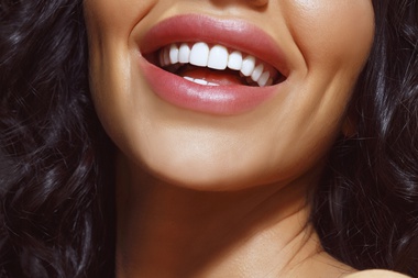 Lip Lift